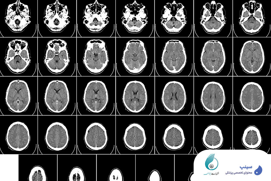 ریپورت نویسی CT و MRI مغز