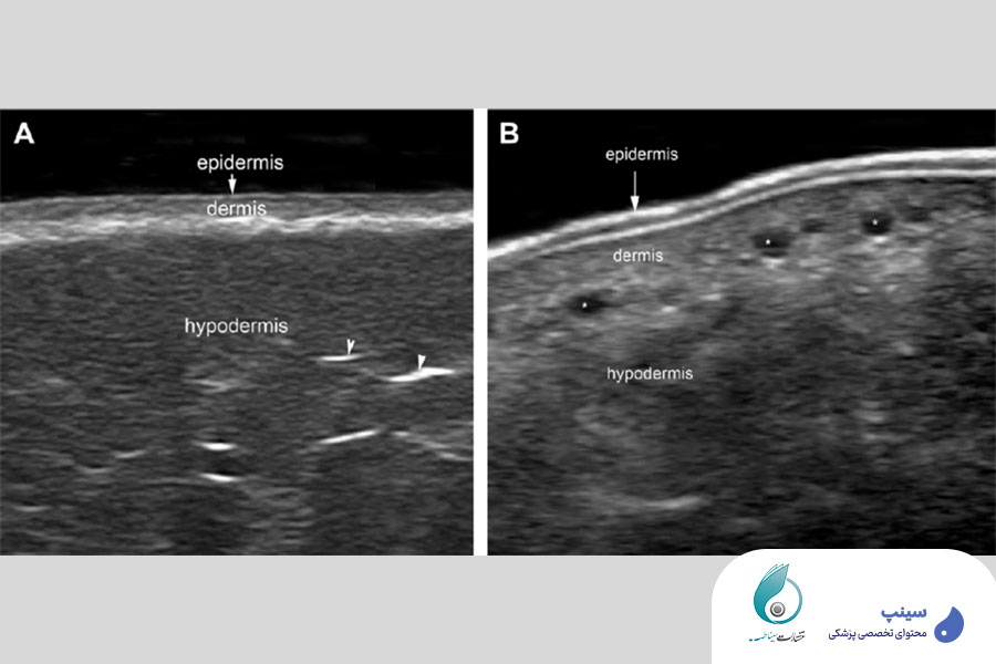 دوره کامل تصویربرداری و سونوگرافی پوست و صورت