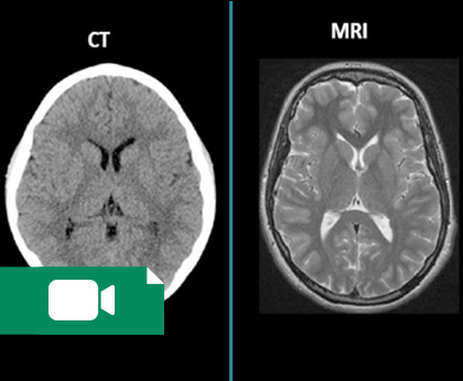 آموزش  رادیولوژی پرکتیکال CT و MRI  مغز و ستون فقرات